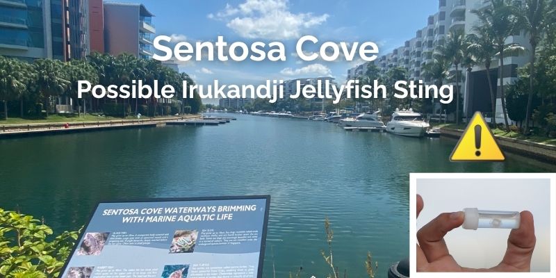 Sentosa Cove ⚠️ Jellyfish Sting Incident – Please Read
